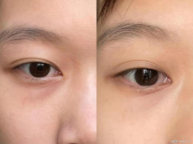 推荐六款眼霜全方位改善眼周肌肤凯发入口什么眼霜去皱效果好？(图5)